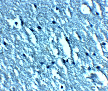 TRPC3 Antibody