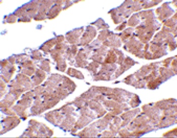 TRPC3 Antibody