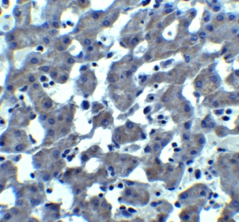 Trophinin Antibody