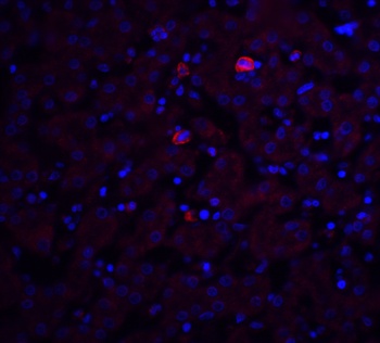 Trophinin Antibody