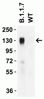 SARS-CoV-2 Spike P681H Antibody (Alpha, Mu Variant)