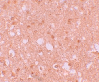 TRIM71 Antibody