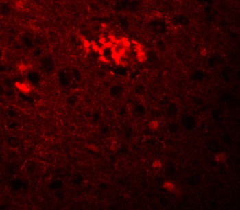 TRIM71 Antibody