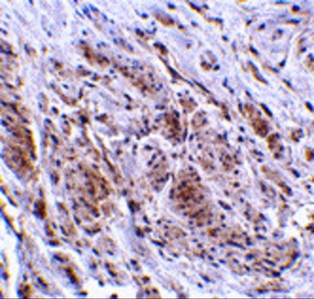 TRIM5 Antibody