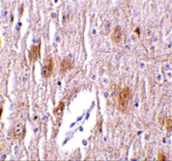 TRIM5 Antibody