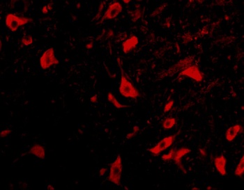 TRIM5 Antibody