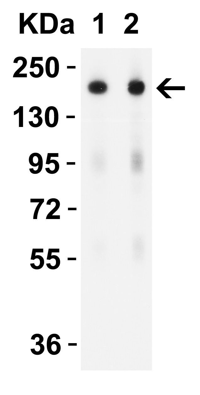 SARS-CoV-2 (COVID-19) Spike S2 Antibody [5E6]