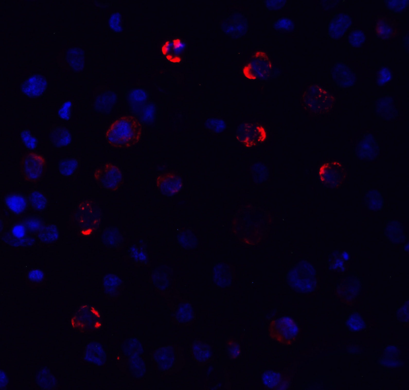 SARS-CoV-2 (COVID-19) Spike S2 Antibody [5E6]