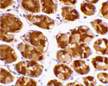 TRIM5 Antibody