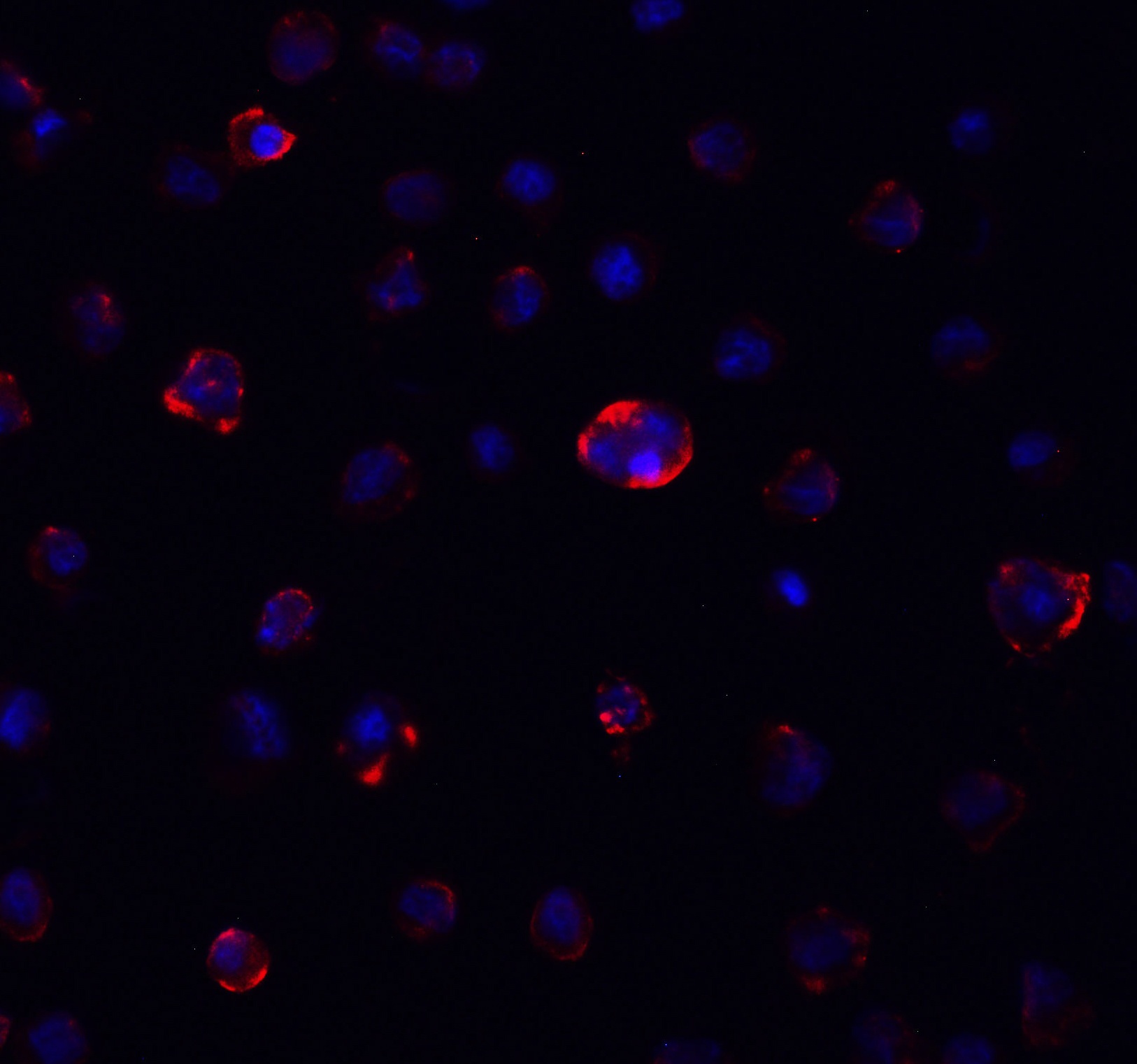 SARS-CoV-2 (COVID-19) Spike S2 Antibody [4F10]