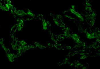 TRIF Antibody