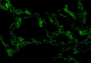 TICAM1 Antibody