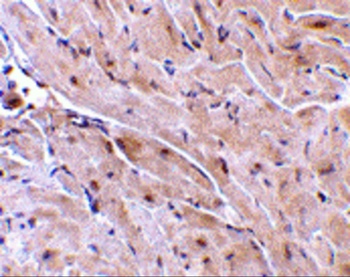 RNF216 Antibody