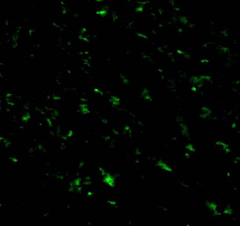 RNF216 Antibody