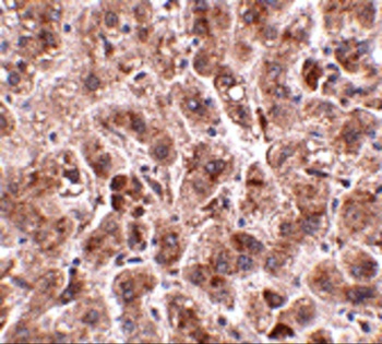 TREX2 Antibody