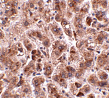 TREX2 Antibody