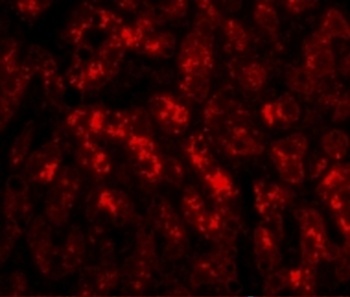 TREX2 Antibody