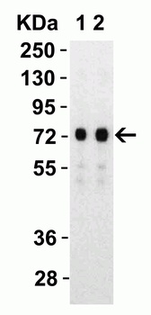 SARS-CoV-2 (COVID-19) Spike S2 Antibody
