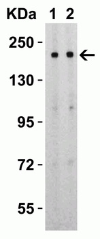 SARS-CoV-2 (COVID-19) Spike S2 Antibody
