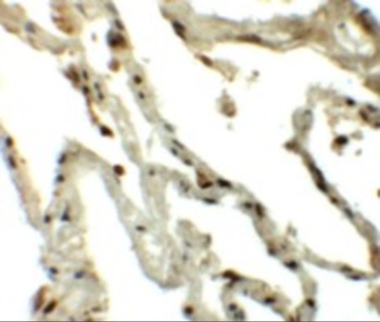 TSN Antibody