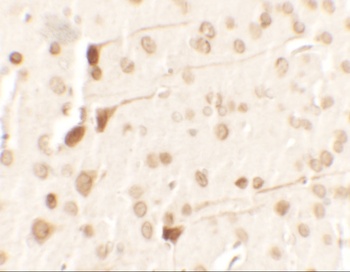 TPT1 Antibody