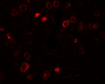 TPT1 Antibody