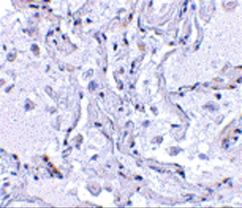 TP1 Antibody