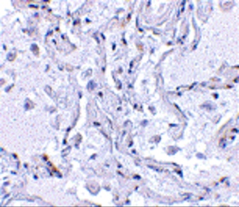 TEP1 Antibody