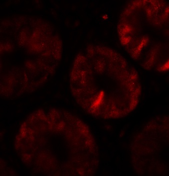 TOX Antibody