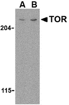 MTOR Antibody