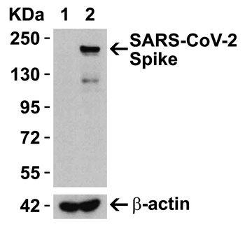 SARS-CoV-2 (COVID-19) Spike Antibody (cleavage site)