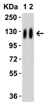 SARS-CoV-2 (COVID-19) Spike Antibody (cleavage site)