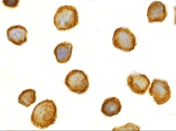 TOLLIP Antibody