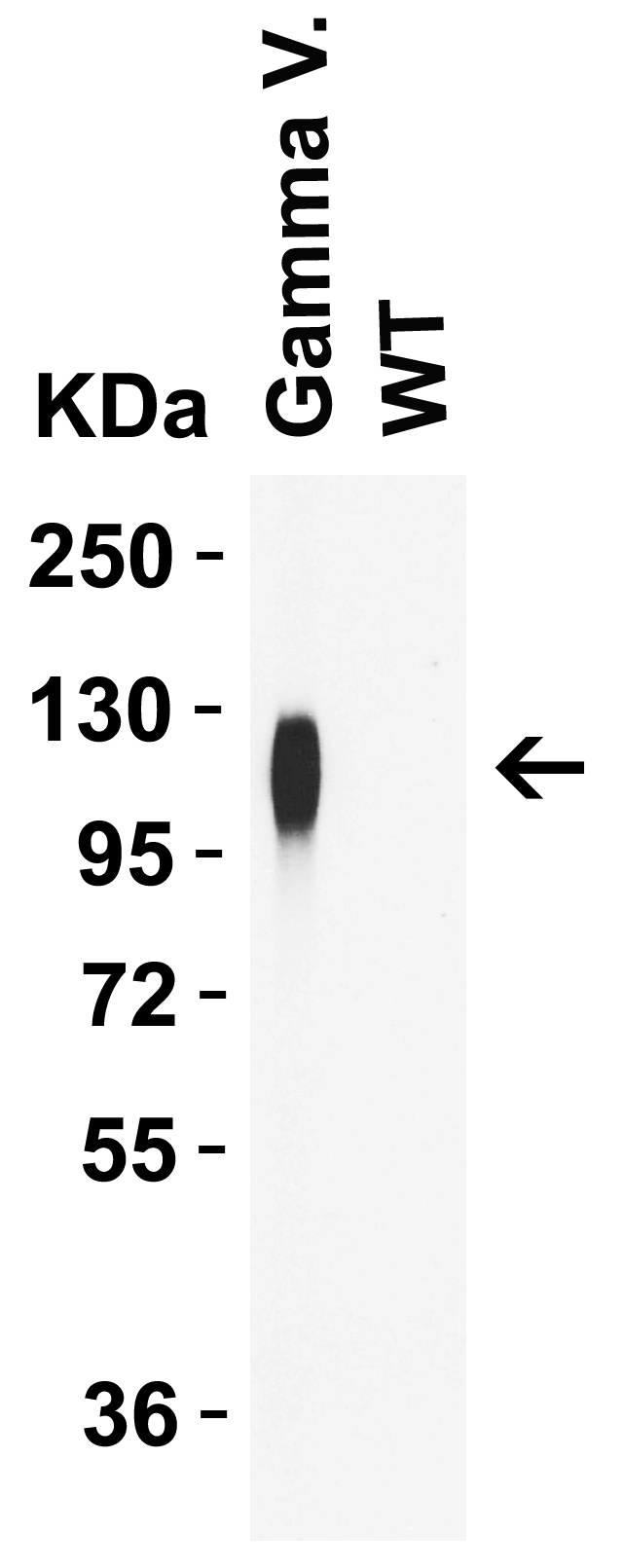 SARS-CoV-2 (COVID-19) Spike P26S Antibody [5G12G11] (Gamma Variant)