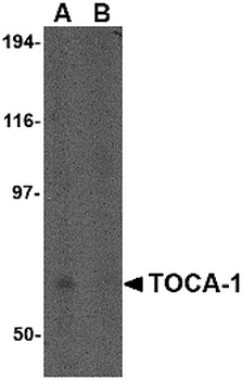 TOCA-1 Antibody