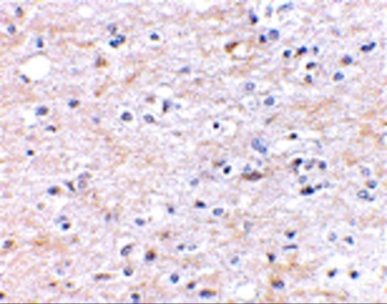 FNBP1L Antibody