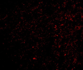 TOCA-1 Antibody