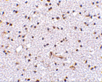 FNBP1L Antibody