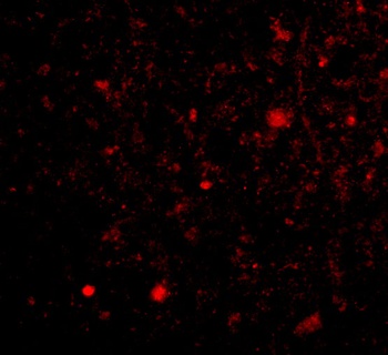 TOCA-1 Antibody