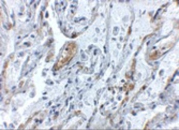 TNFAIP3 Antibody