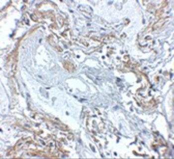 TNFAIP3 Antibody
