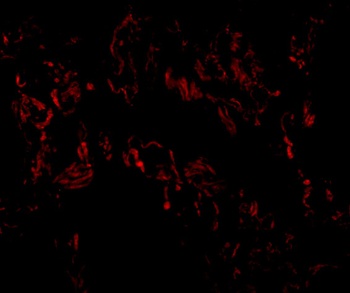 TNFAIP3 Antibody