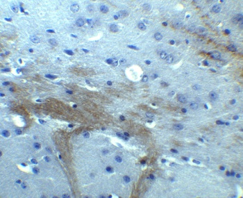 TNFAIP1 Antibody