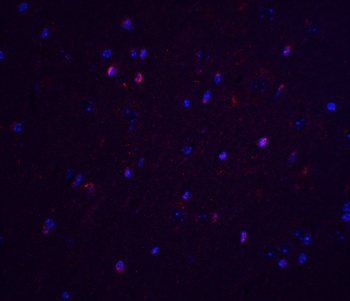 TNFAIP1 Antibody