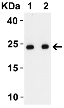 SARS-CoV-2 (COVID-19) Envelope Antibody