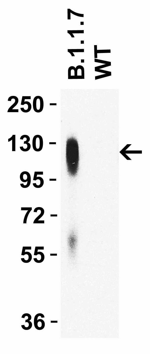 SARS-CoV-2 Spike P681H Antibody [7C11H11] (Omicron, Alpha Variant)