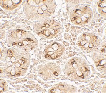 TMIGD2 Antibody