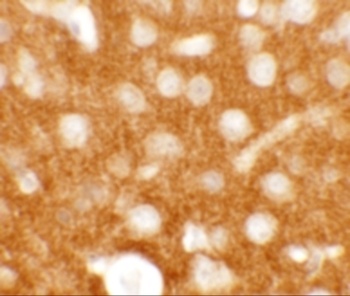 TMEM88 Antibody