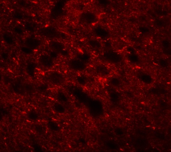 TMEM88 Antibody