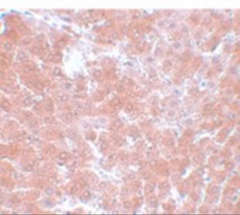 TMEM70 Antibody